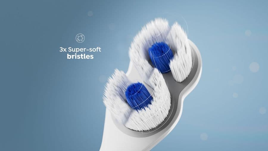 The Orthodontic Cleaning Problem — Solved