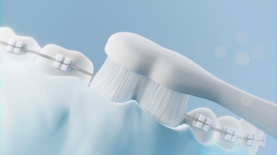 Protect Your Smile With Smart Technology