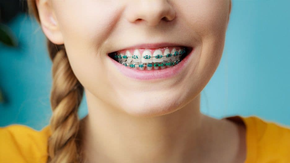 Your Ultimate Guide to Oral Care During Orthodontic Treatment